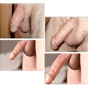 The result of using Big Size gel before and after application on the penis